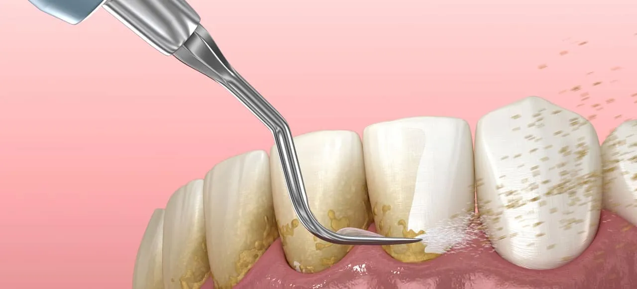 Dental Spa