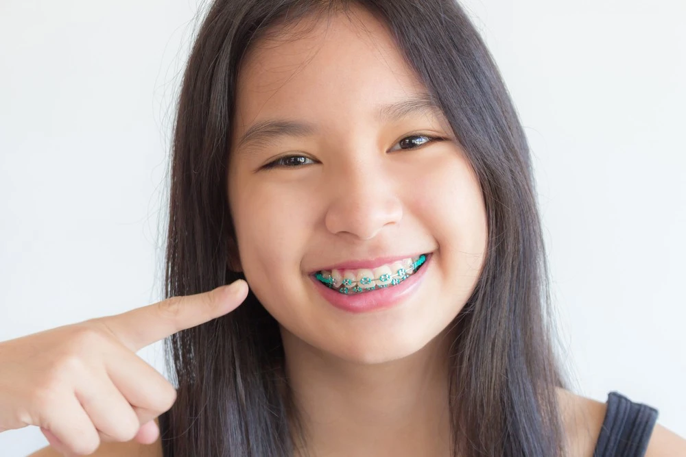 Kids Braces
